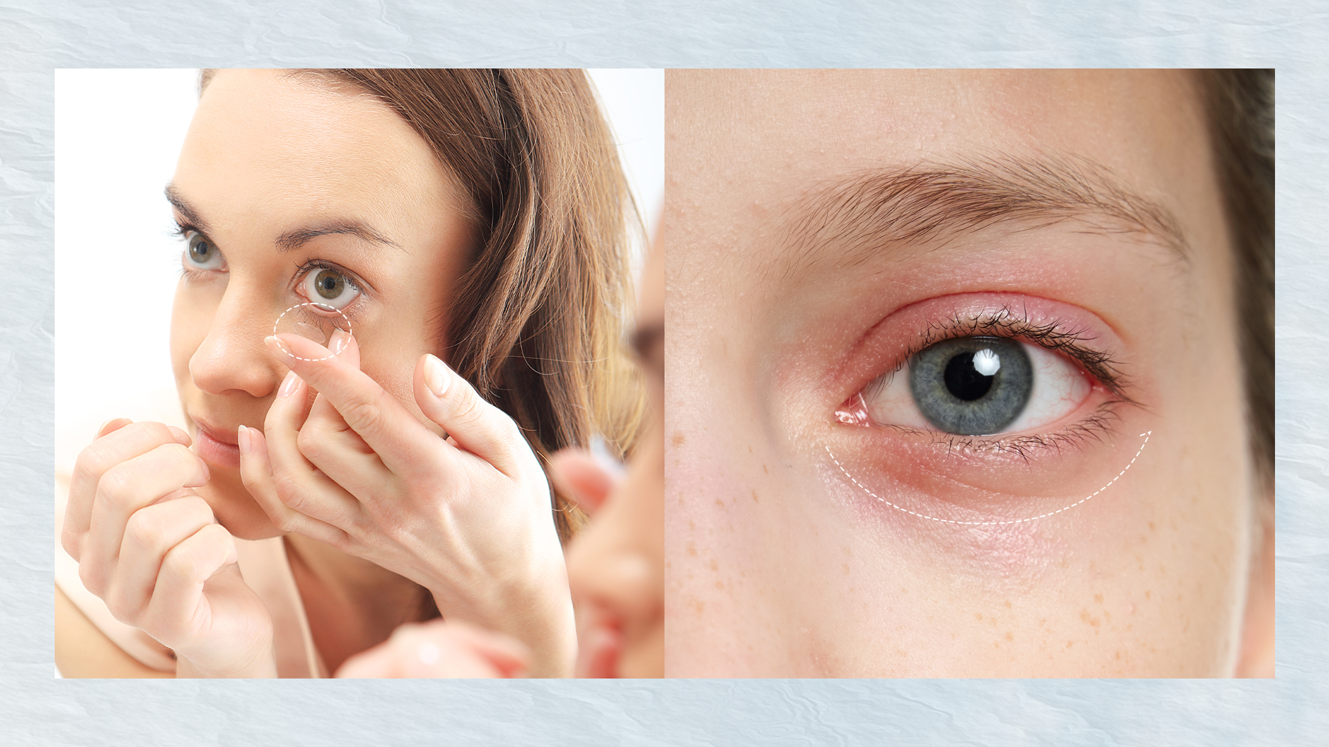 Watch for Warning Signs