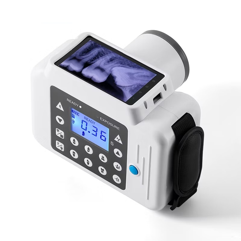 Intra Oral Camera