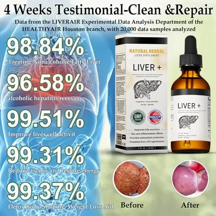 AnnieCare® Natural Herbal Liver Supplement - Powerful Liver Support - Detox & Repair - Lowers Blood Sugar and Lipids