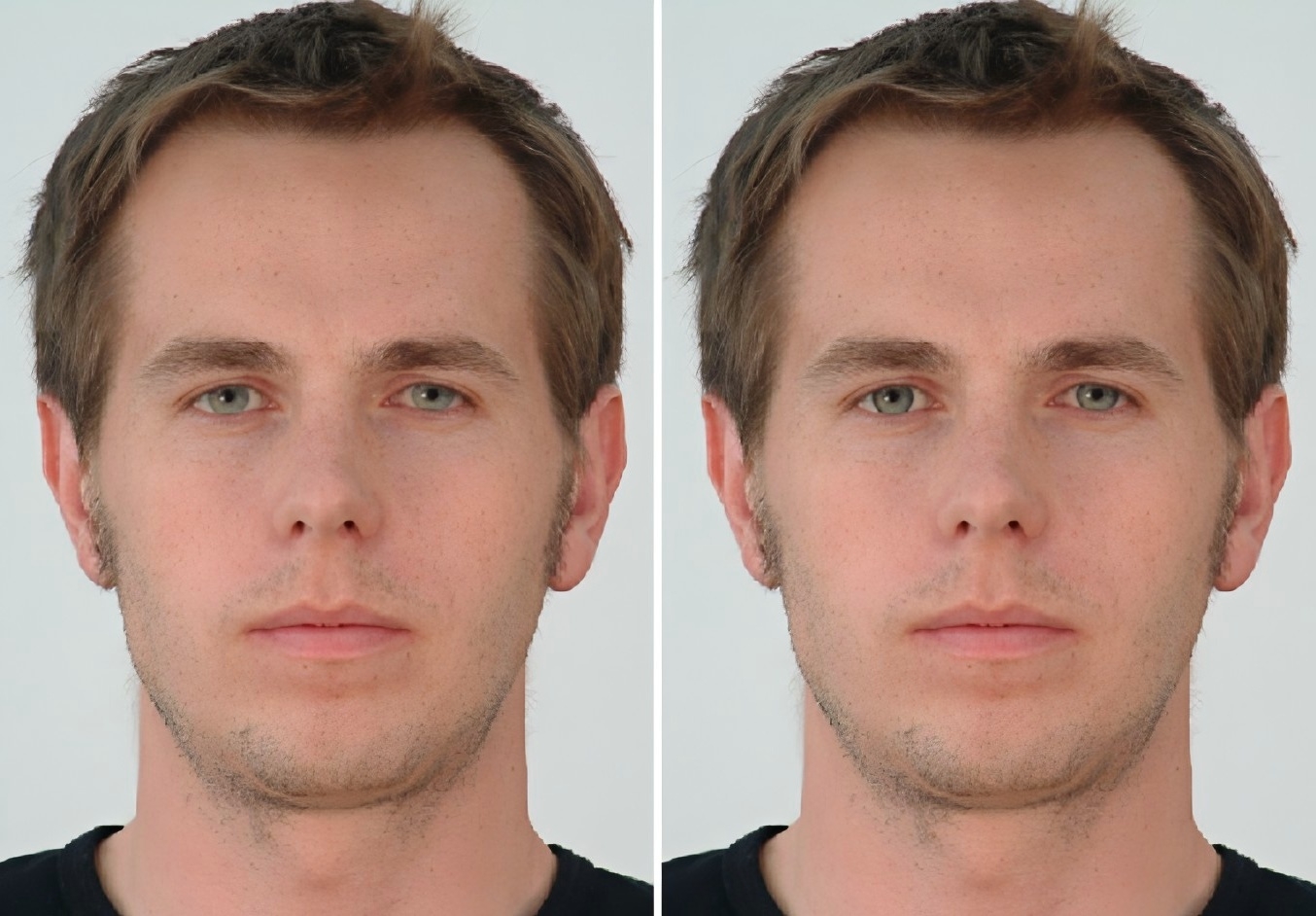 comparison of Limbal Ring VS No Limbal Ring