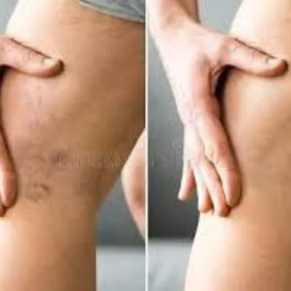 pornhint Pornhint Anti Cellulite Massage Oil