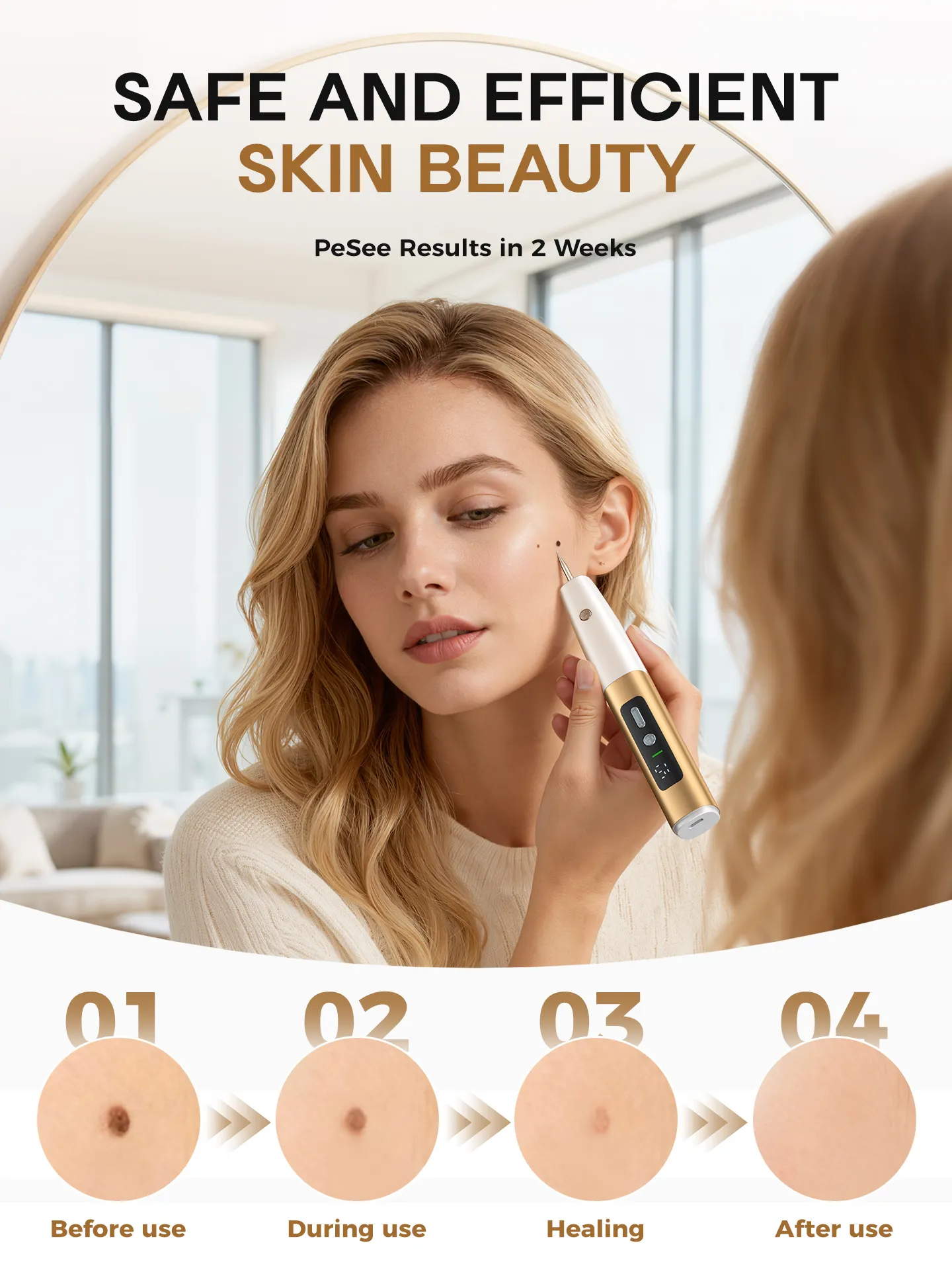 skin tag