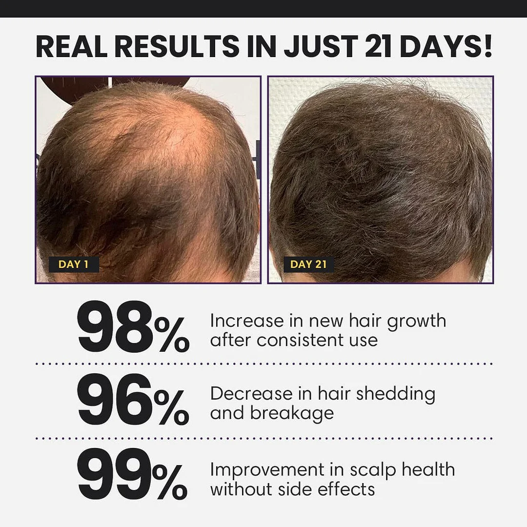 Hair Growth Serum 🪮