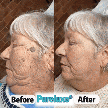 Pureluxo®