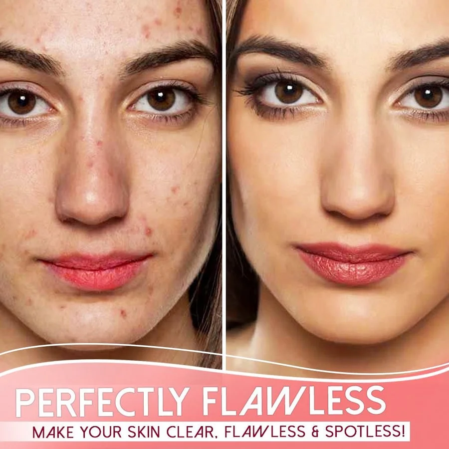 Suupillid™ Organic Skin Purifying Dark Spot Serum