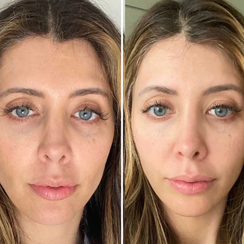 Nadove Eyecare Pro &ndash; 2024 New Year Hot Sale 60% OFF