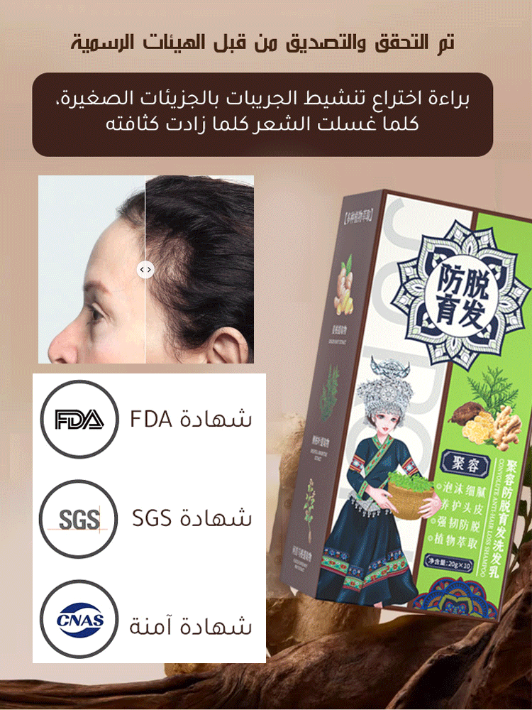 شامبو الزنجبيل المضاد لتساقط الشعر الأكثر مبيعا