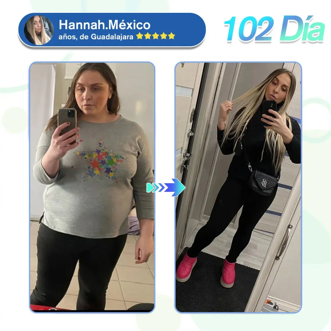 	CROAIE&reg; SMGT-GLP-1 Nano-Parche de Microagujas