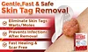 🌈MicroNeedle Botanic Skin Tag Removal Patch 🇺🇸 Made in the USA