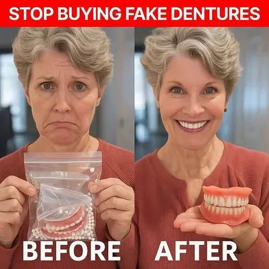 💥 ENDS TODAY 80% OFF🔥 HazyGalaxy&trade; Custom-Fit Dentures 🦷Smile with Confidence