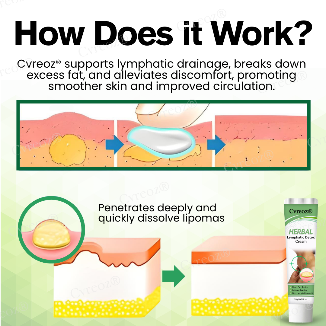 🔥Hot Sale 49% Off🔥 Herbal Lymphatic Detox Cream