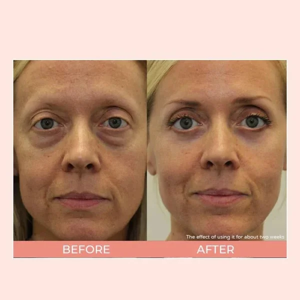 👁️Retinol Eye Cream Stick👁️🔥🔥