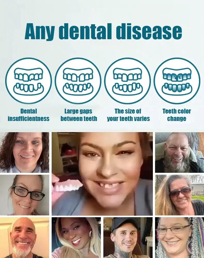 🍎✨10-Second Facial Reconstruction &mdash; Fill Your Wrinkles & Smooth Your Smile! Look 20 Years Younger Instantly!