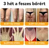 🌿 VLSVLS&reg; M&eacute;hm&eacute;reg Bőrhelyre&aacute;ll&iacute;t&oacute; Kr&eacute;m 🔥 UTOLS&Oacute; NAP &ndash; 80% KEDVEZM&Eacute;NY 🌟