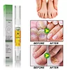 Anti-Fungal Pen – Gets Rid Of Even the Most Stubborn Nail Fungus