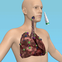OnNature Organic Herbal Lung Cleanse & Repair Nasal Spray PRO