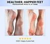 Electric Feet Callus Remover