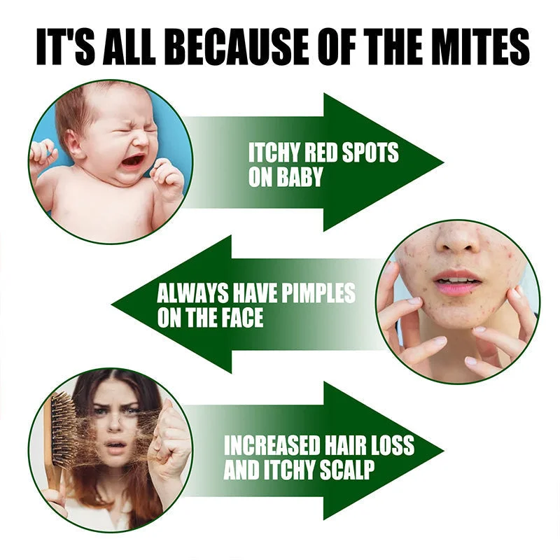 Effective Mite Removal Spray - Deep Cleans and Protects Health