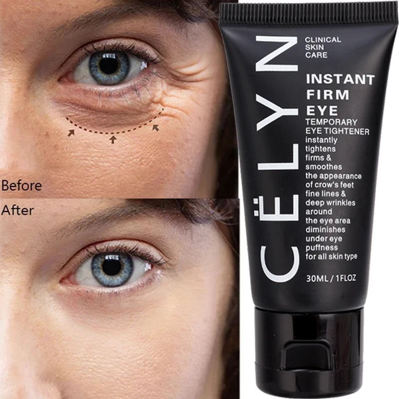 🎁[Free Shipping]CËLYN Instant Firm Eye Cream