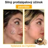 🧑&zwj;⚕️O&scaron;etrenie kožn&yacute;ch probl&eacute;mov zahňa: vekov&eacute; &scaron;kvrny, jazvy, bradavice, kožn&eacute; akn&eacute;, furuncle, akn&eacute;, ekz&eacute;my, psori&aacute;za, acne inversa, akn&eacute;, jazvy po akn&eacute; a in&eacute;.