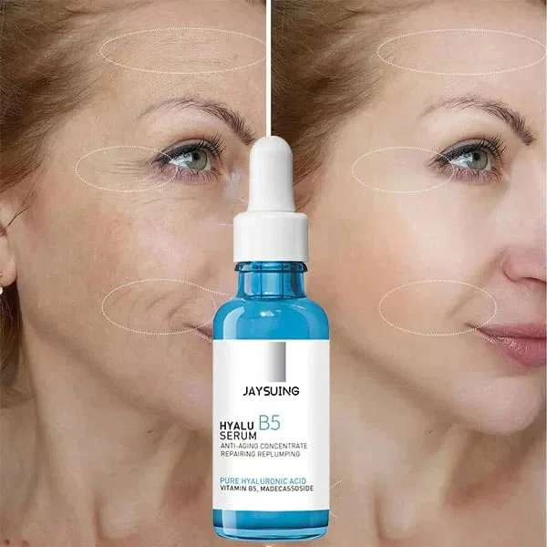 🔥Last Day Promotion 49% OFF & Free Shipping🔥-Botox Face Serum