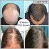 🎉Hot sale-49%OFF--SCALP INTENSE - HAIR GROWTH SERUM