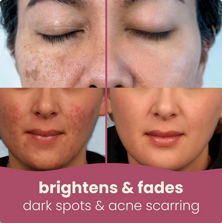 Natural Brightening Turmeric & Kojic Acid Pads | 50 Pack