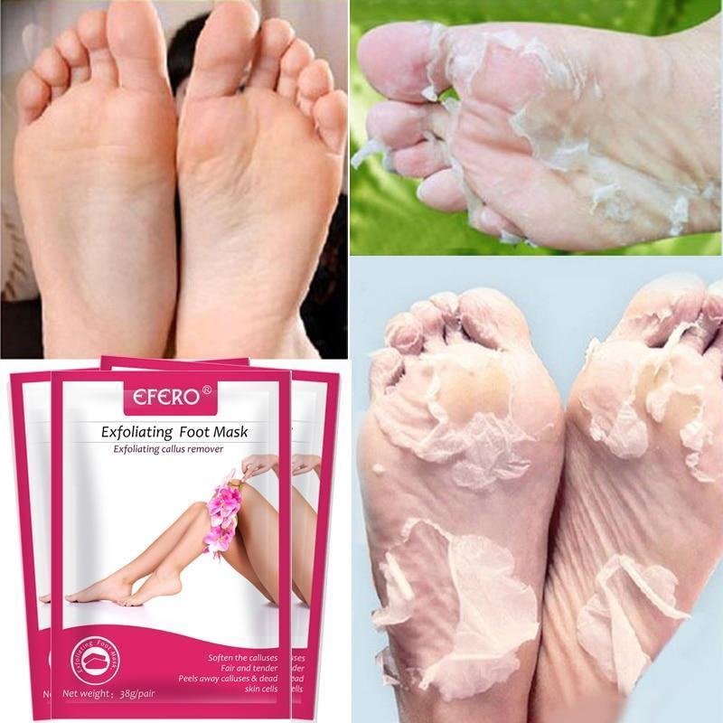  Ultimate Foot Peeling Mask