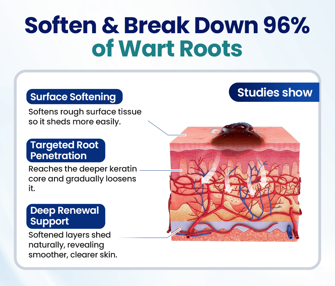 ROSOPL® WartLift Wart Removal Fluid 29 Timilk® WartLift Corn Removal Liquid (A)