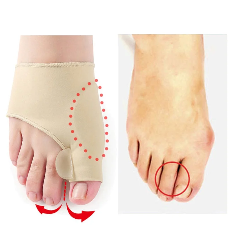 Orthopedic Gel Bunion Corrector (2 Piece Set)
