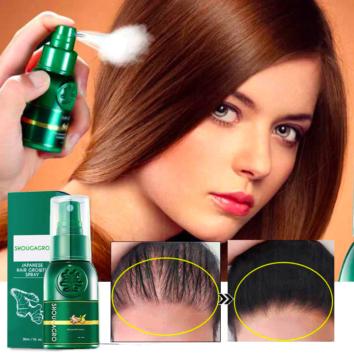 Japanese Hair Growth Spray⚡️3 PCS Free Shipping⚡️