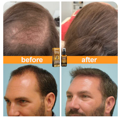 View of Biotin Hair Growth Serum