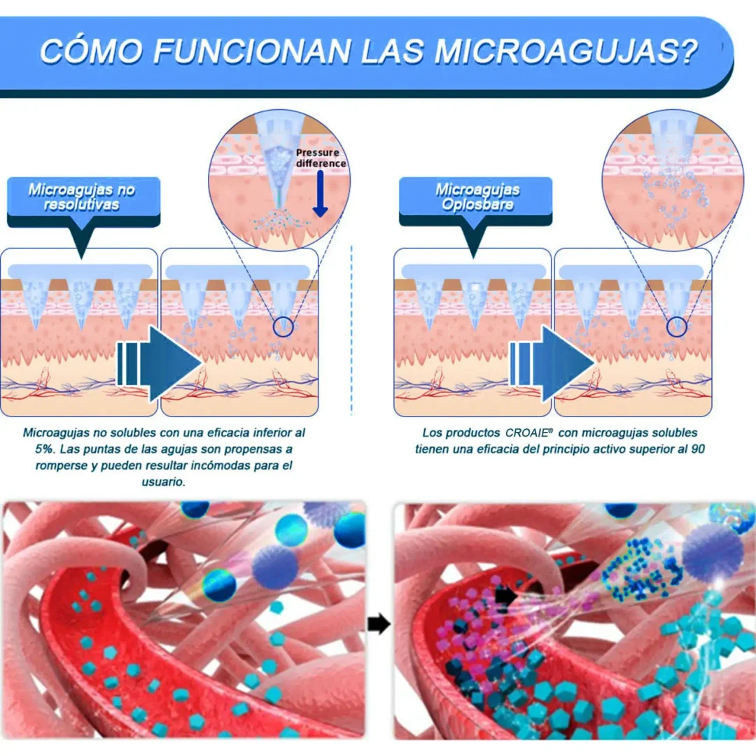 	CROAIE&reg; SMGT-GLP-1 Nano-Parche de Microagujas