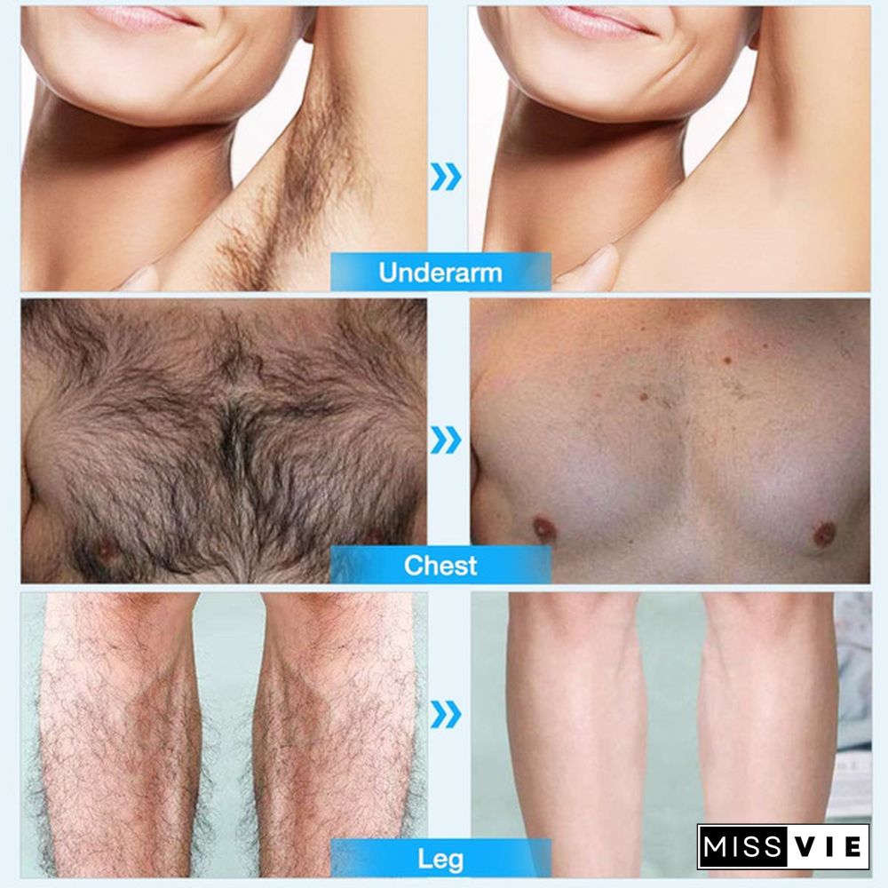 10ml/Permanent Hair Removal Spray Inhibiting and Reducing To Stop Hair Growth