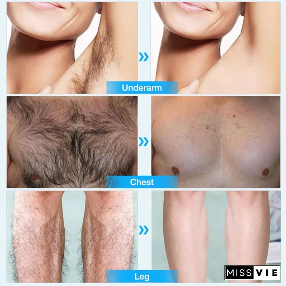 10ml/Permanent Hair Removal Spray Inhibiting and Reducing To Stop Hair Growth