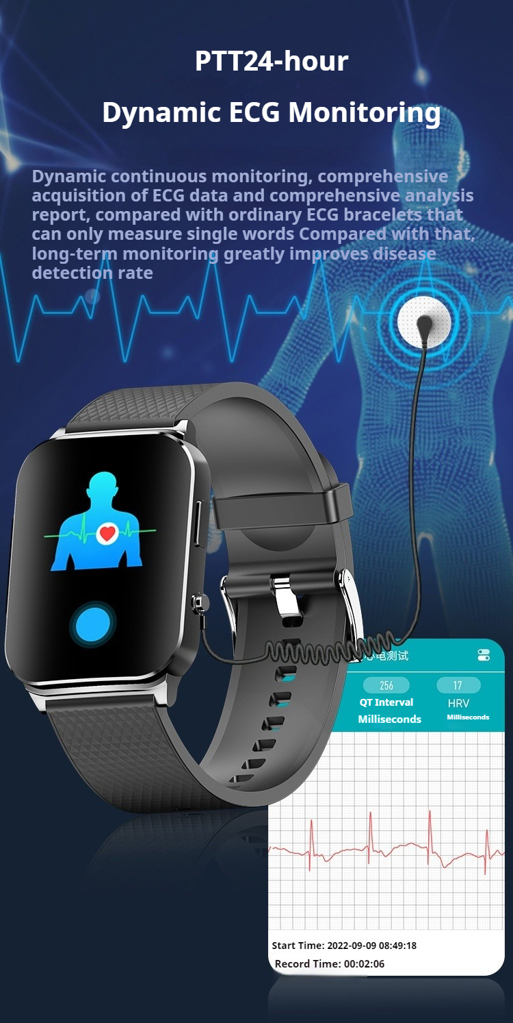 Likron Watches