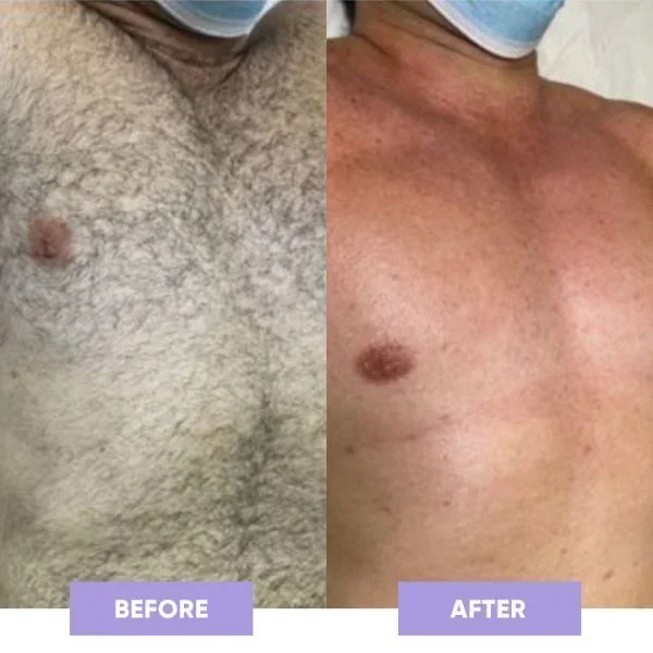 🔥BUY 1 GET 1 FREE &ndash; CRYSTAL HAIR ERASER