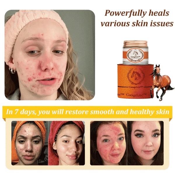 👑2025 New Horse Oil Therapy Cream (👨‍⚕ACD 𝐑𝐄𝐂𝐎𝐌𝐌𝐄𝐍𝐃𝐒)