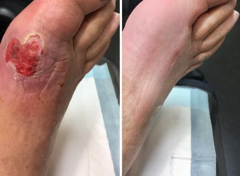 DOCTIA™ BeeVenom FungiVanish Treatment Spray