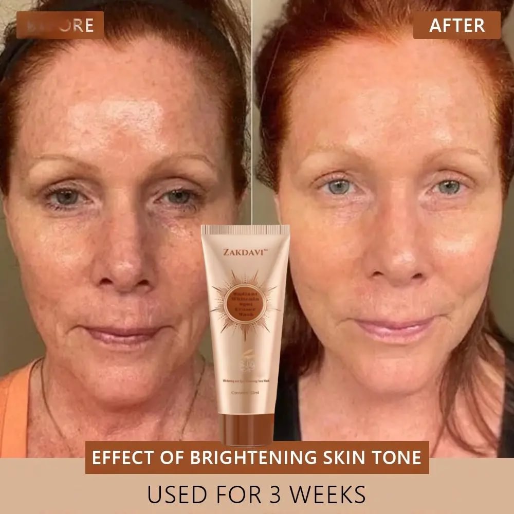 	Zakdavi&trade; Radiant Whitening & Spot Eraser Mask