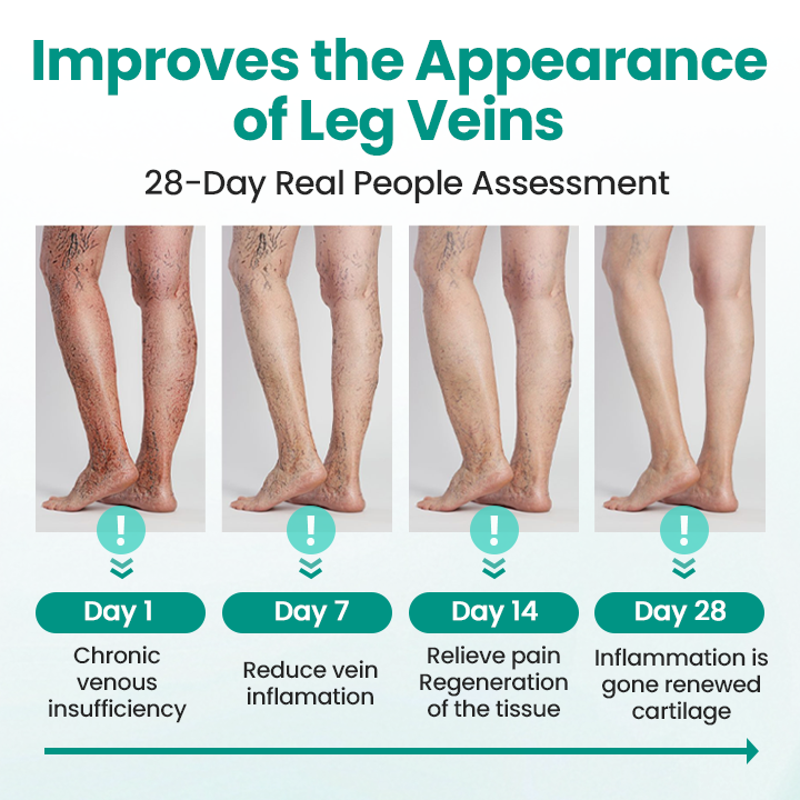 LegRenew Varicose Veins Patch