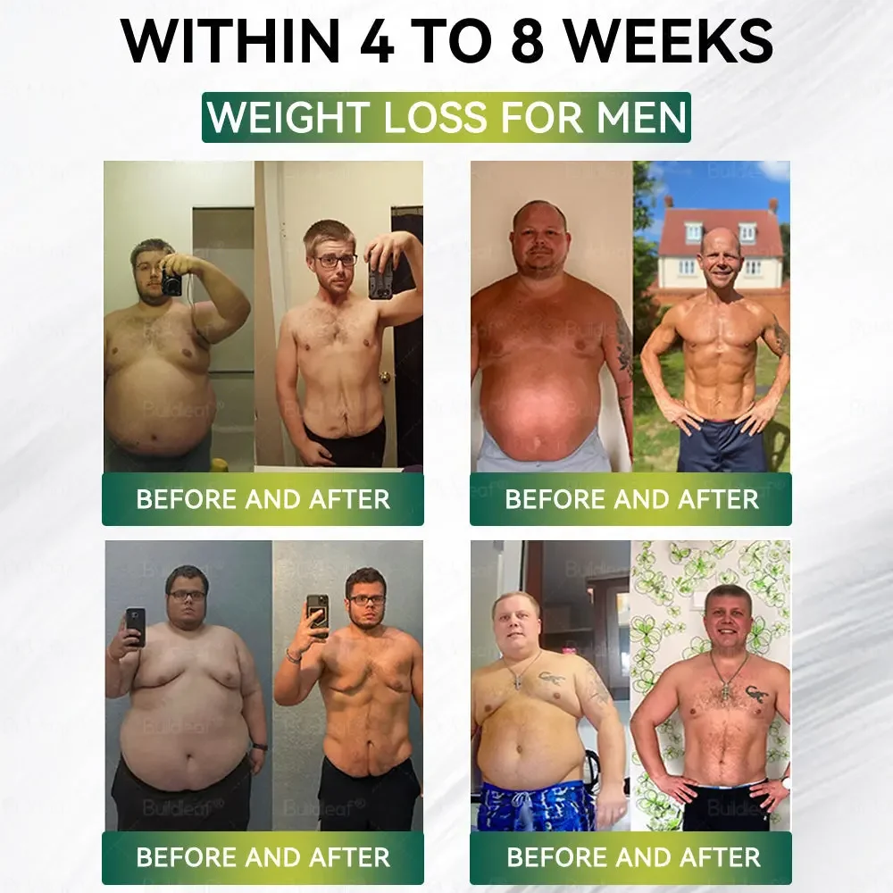 	Buildleaf&reg; SMGT-GLP-1 Nano Microneedle Patch with Collagen Peptides &Matrixyl 3000