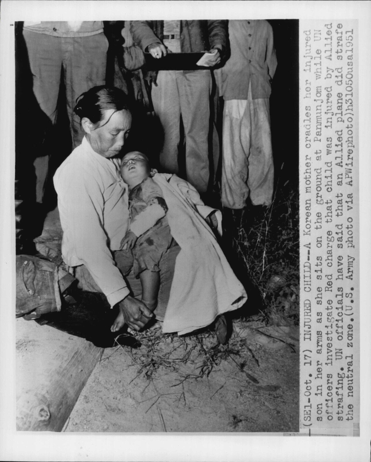 Injured Child at Panmunjom Peace Talks 1951 Korea War Press Photo Poster painting