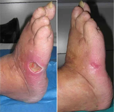 DOCTIA™ Bienen-Gift PilzVanis h Behandlungs spray