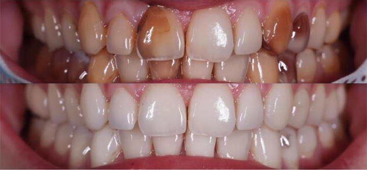 Rosopl® Multi-Action Oral Care Essence 26