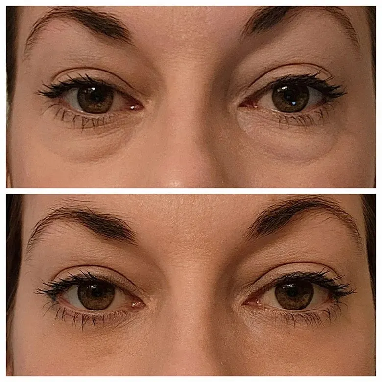 Last Day 49% OFF🎁Instant Eye Temporary Eye Tightener💕