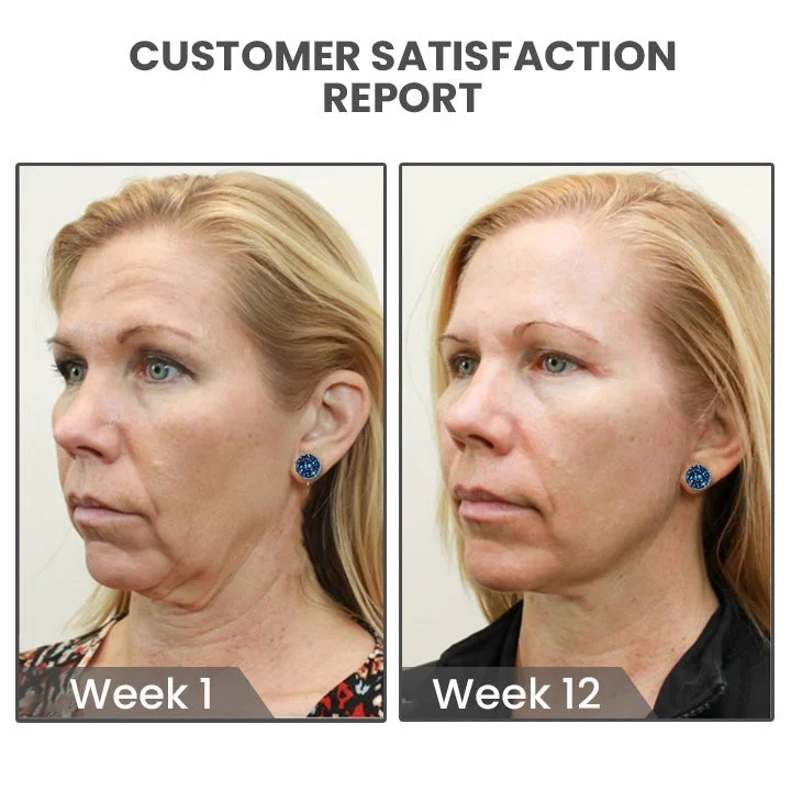 Atheniz Magnetology Lymphvity Germanium Earrings（Limited Time Discount 🔥 Last Day）