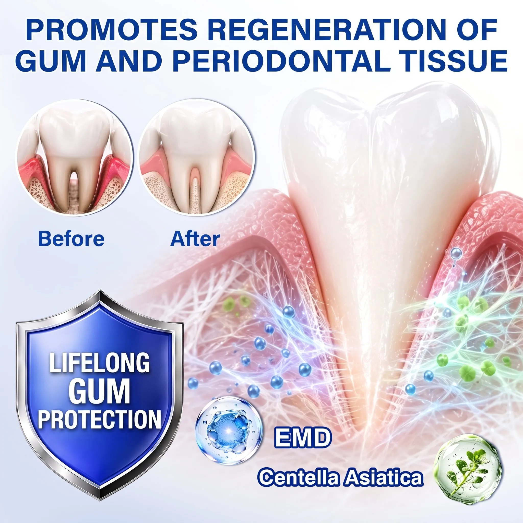 Periodontal regeneration support