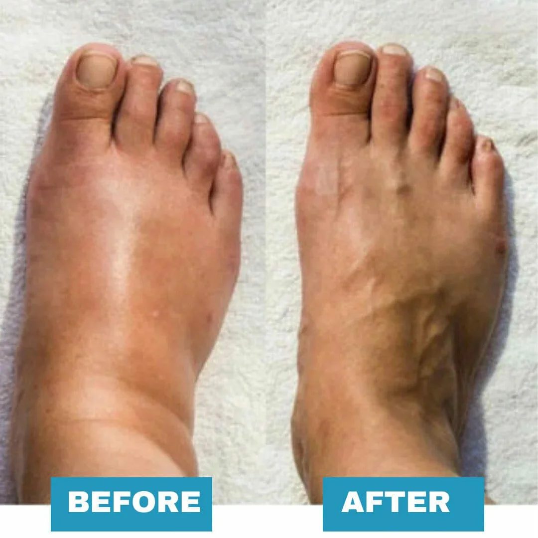 Foot Massager &ndash; For Lasting Foot Pain Relief &ndash; Mother's day Sale OFF 60%