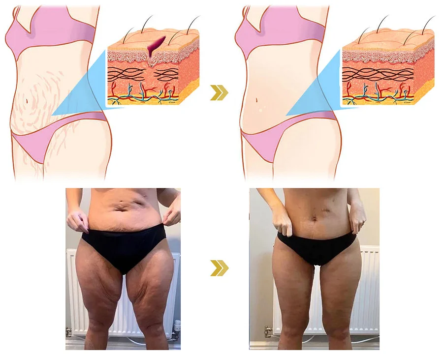 Laozik™ Botox Bee poison Firming Serum Stick